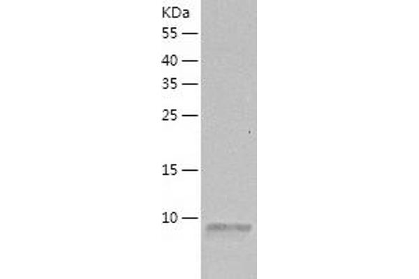 SDF1 beta Protein (AA 22-93) (His tag)