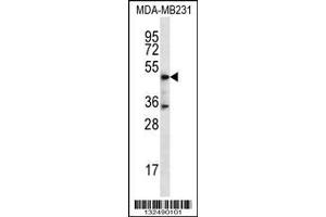 Image no. 1 for anti-Kinetochore-associated protein DSN1 homolog (DSN1) (AA 257-286), (C-Term) antibody (ABIN656747)