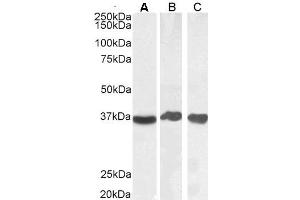 Image no. 4 for anti-Glyceraldehyde-3-Phosphate Dehydrogenase (GAPDH) (Internal Region) antibody (ABIN185543)