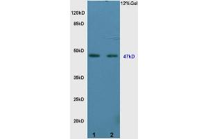Image no. 3 for anti-Vitamin D Receptor (VDR) (AA 65-180) antibody (ABIN682513)