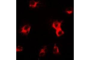 Image no. 3 for anti-Sarcoglycan, delta (35kDa Dystrophin-Associated Glycoprotein) (SGCD) antibody (ABIN3198032)