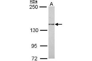 WB Image Sample (30 ug of whole cell lysate) A: MCF-7 5% SDS PAGE antibody diluted at 1:1000