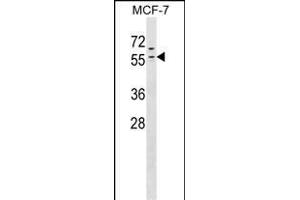 ZN Antibody (N-term) (ABIN1538932 and ABIN2849449) western blot analysis in MCF-7 cell line lysates (35 μg/lane).