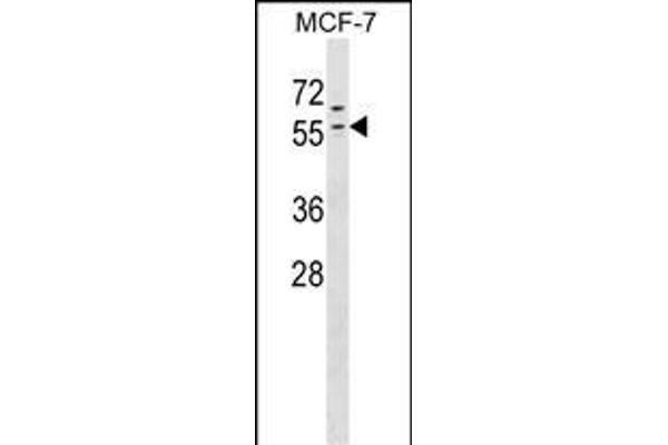 ZNF383 抗体  (N-Term)