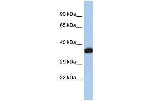 Image no. 1 for anti-GTPase, IMAP Family Member 2 (GIMAP2) (Middle Region) antibody (ABIN2786558)