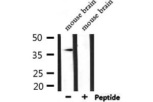 Image no. 3 for anti-Aldo-Keto Reductase Family 1, Member C3 (3-alpha Hydroxysteroid Dehydrogenase, Type II) (AKR1C3) antibody (ABIN6259862)