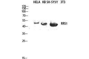 Image no. 2 for anti-RRS1 Ribosome Biogenesis Regulator (RRS1) (Internal Region) antibody (ABIN3186842)