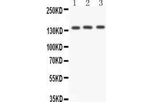 Image no. 2 for anti-Angiotensin I Converting Enzyme (Peptidyl-Dipeptidase A) 1 (ACE) (AA 702-715), (Middle Region) antibody (ABIN3042841)