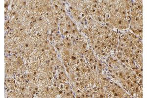 ABIN6274503 at 1/100 staining Human liver tissue by IHC-P.