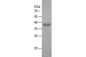 NBL1 Protein (AA 17-181) (IF2DI tag)
