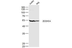 Image no. 1 for anti-Zinc Finger, CCHC Domain Containing 4 (ZCCHC4) (AA 301-400) antibody (ABIN5675689)