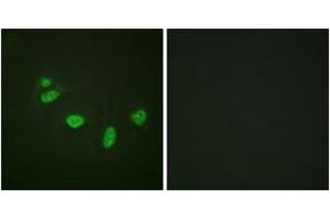 Immunofluorescence analysis of HeLa cells, using ETS1 (Phospho-Thr38) Antibody.