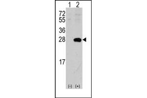 Image no. 1 for anti-sigma Non-Opioid Intracellular Receptor 1 (SIGMAR1) (N-Term) antibody (ABIN357896)