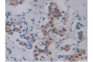 Image no. 2 for anti-Pancreas Specific Transcription Factor, 1a (PTF1A) (AA 177-328) antibody (ABIN2918928)