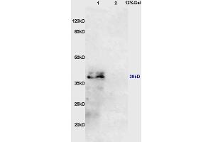 Image no. 1 for anti-Interleukin 10 Receptor, beta (IL10RB) (AA 21-120) antibody (ABIN747848)