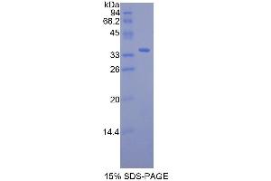Image no. 1 for Retinol Binding Protein 3, Interstitial (RBP3) (AA 18-320) protein (His tag) (ABIN1080641)