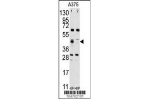 Western Blotting (WB) image for anti-Farnesyl-Diphosphate Farnesyltransferase 1 (FDFT1) (Center) antibody (ABIN2161174)