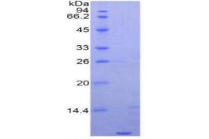 Image no. 4 for Apolipoprotein C-I (APOC1) ELISA Kit (ABIN6730889)