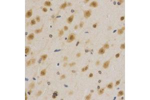 Image no. 10 for anti-ELAV (Embryonic Lethal, Abnormal Vision, Drosophila)-Like 1 (Hu Antigen R) (ELAVL1) antibody (ABIN3022231)