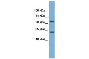 Image no. 1 for anti-Phosphatidylinositol 4-Kinase, Catalytic, beta (PI4KB) (Middle Region) antibody (ABIN928849)