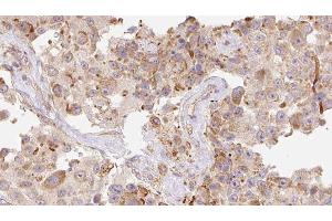 Image no. 1 for anti-Cathelicidin Antimicrobial Peptide (CAMP) (Internal Region) antibody (ABIN6260498)