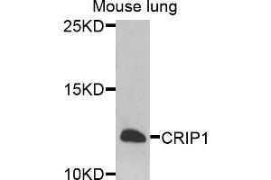 Image no. 1 for anti-Cysteine-Rich Protein 1 (Intestinal) (CRIP1) antibody (ABIN6571209)
