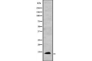 anti-Chemokine (C-C Motif) Ligand 24 (CCL24) (C-Term) antibody