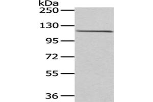 Gel: 6 % SDS-PAGE,Lysate: 40 μg,Primary antibody: ABIN7193040(WDR36 Antibody) at dilution 1/200 dilution,Secondary antibody: Goat anti rabbit IgG at 1/8000 dilution,Exposure time: 1 minute