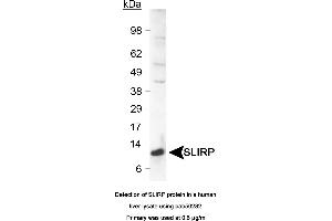 Image no. 1 for anti-SRA Stem-Loop Interacting RNA Binding Protein (SLIRP) (C-Term) antibody (ABIN363541)