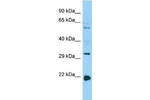 Image no. 1 for anti-Coronin, Actin Binding Protein, 1B (CORO1B) (C-Term) antibody (ABIN2790746)