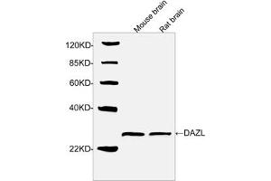 Image no. 1 for anti-Deleted in Azoospermia-Like (DAZL) (N-Term) antibody (ABIN1574207)