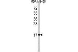 Image no. 1 for anti-Interleukin 8 (IL8) (C-Term) antibody (ABIN453704)