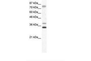 Image no. 1 for anti-Zinc Finger Protein 570 (ZNF570) (AA 68-117) antibody (ABIN6736005)