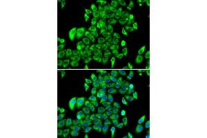 Image no. 3 for anti-Ribosomal Protein L13 (RPL13) antibody (ABIN6147109)