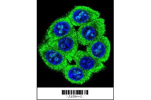 Image no. 2 for anti-Protein Associated with Topoisomerase II Homolog 2 (PATL2) (Center) antibody (ABIN2495426)