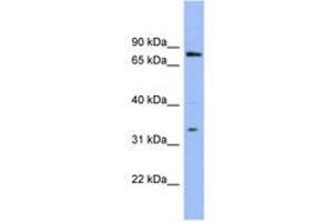 Image no. 1 for anti-Zinc Finger Protein 278 (ZNF278) (AA 35-84) antibody (ABIN6741631)