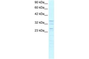 Image no. 1 for anti-Zinc Finger Protein 385A (ZNF385A) antibody (ABIN2460293)