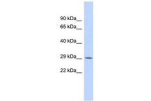 Image no. 1 for anti-Regulatory Factor X-Associated Protein (RFXAP) (AA 179-228) antibody (ABIN6740333)