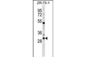 Image no. 1 for anti-Homeobox D1 (HOXD1) (AA 14-42), (N-Term) antibody (ABIN5531401)