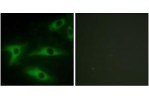 Image no. 3 for anti-Collagen, Type I, alpha 2 (COL1A2) (AA 471-520) antibody (ABIN1534337)