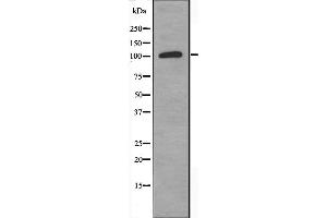 Image no. 1 for anti-Adenylate Cyclase 4 (ADCY4) (Internal Region) antibody (ABIN6256933)
