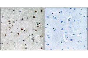 Image no. 2 for anti-Regulatory Factor X 3 (RFX3) (AA 641-690) antibody (ABIN1535421)