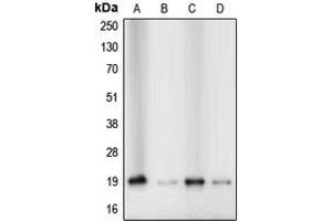 Image no. 3 for anti-Cofilin 1 (CFL1) (N-Term) antibody (ABIN2707432)