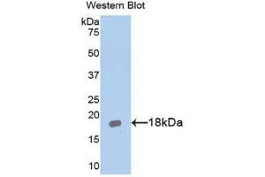 Image no. 1 for anti-Interleukin 18 Receptor Accessory Protein (IL18RAP) (AA 396-548) antibody (ABIN1174895)
