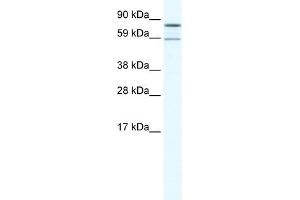 Image no. 1 for anti-Poly A Specific Ribonuclease (PARN) (N-Term) antibody (ABIN2780071)