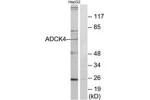 Image no. 2 for anti-AarF Domain Containing Kinase 4 (ADCK4) (AA 31-80) antibody (ABIN1534065)