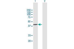 Western Blot analysis of TXNDC5 expression in transfected 293T cell line by TXNDC5 MaxPab polyclonal antibody.