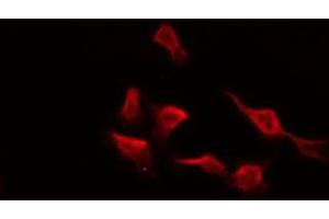 Image no. 1 for anti-Endothelin Receptor Type A (EDNRA) antibody (ABIN6257158)
