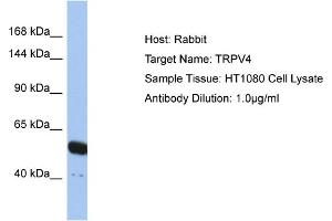 Image no. 1 for anti-Transient Receptor Potential Cation Channel, Subfamily V, Member 4 (TRPV4) (N-Term) antibody (ABIN2776241)