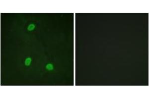 Image no. 2 for anti-Zinc Finger, C3HC-Type Containing 1 (ZC3HC1) (AA 320-369) antibody (ABIN1532748)